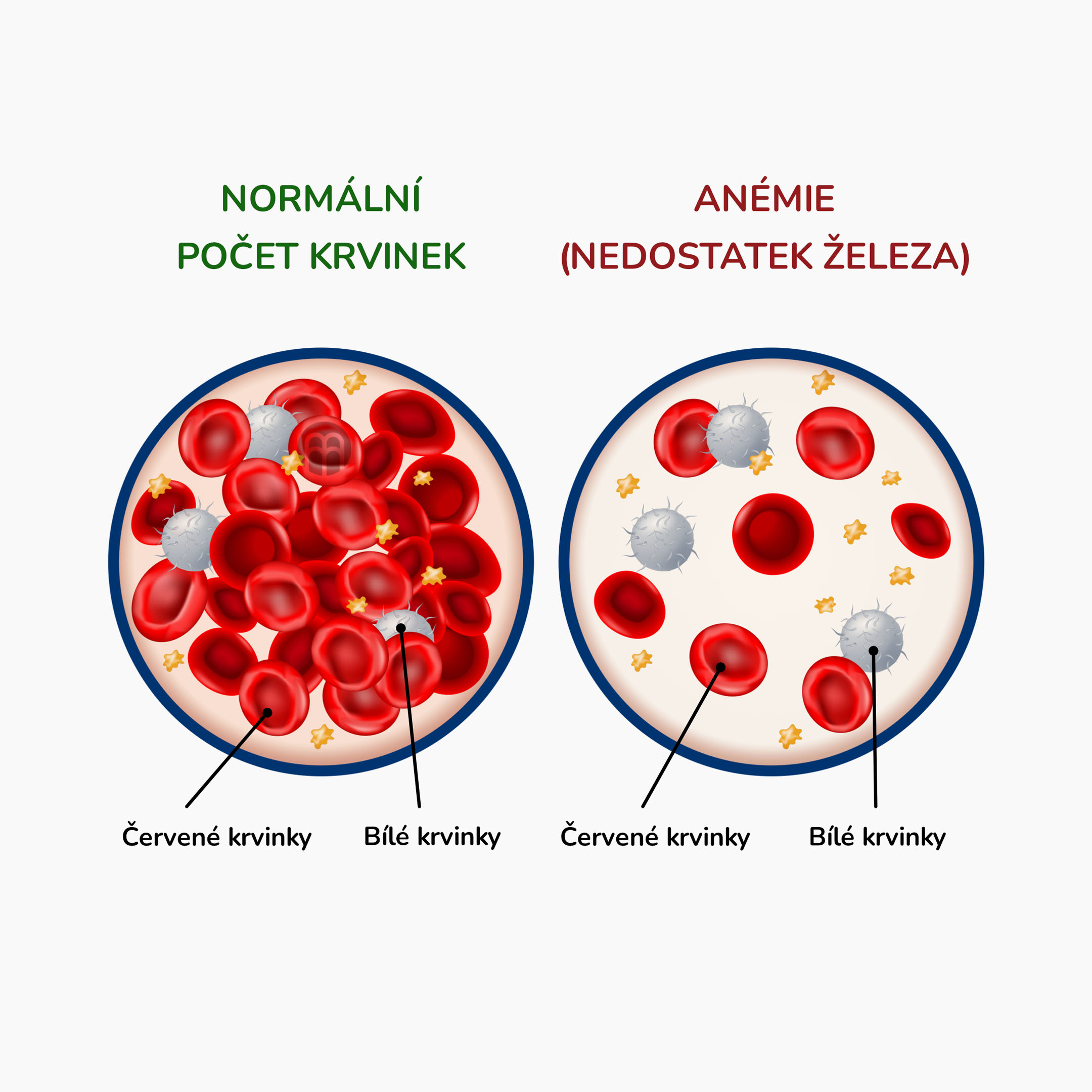 anemia_infografika_cz
